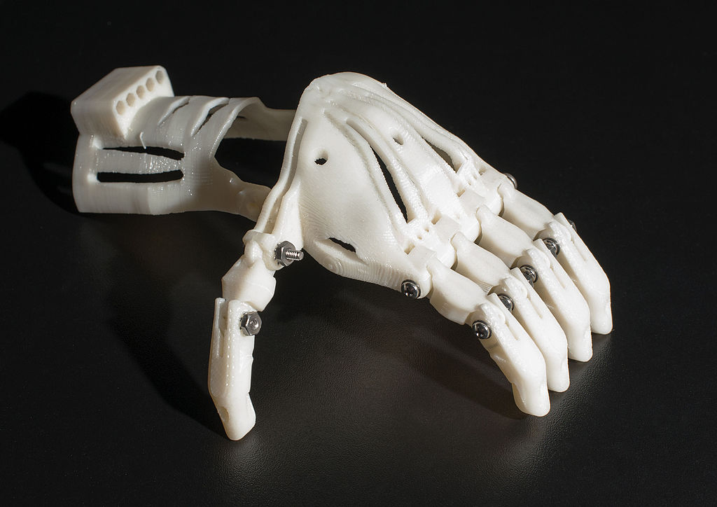 3D printed prosthetic hand