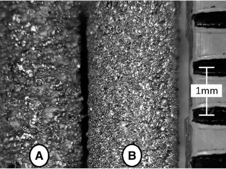 EBM (A) versus DMLS (B) implant. DMLS, direct metal laser sintering; EBM, electron beam melting.